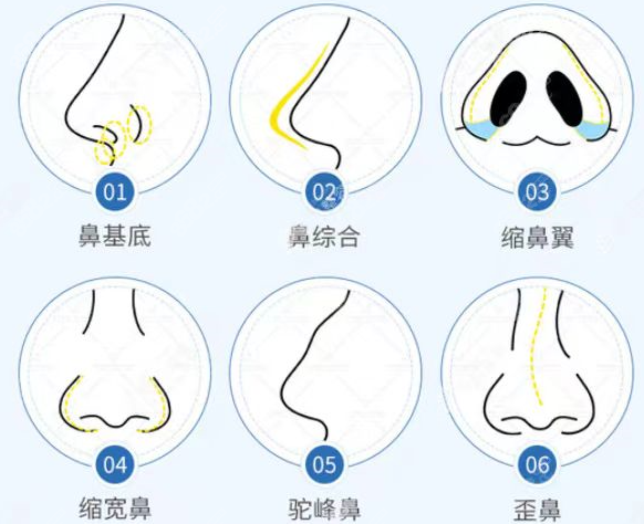 8682赴韩整形网_代表作_整容交流平台,韩国整形,中国赴韩整形美容门户